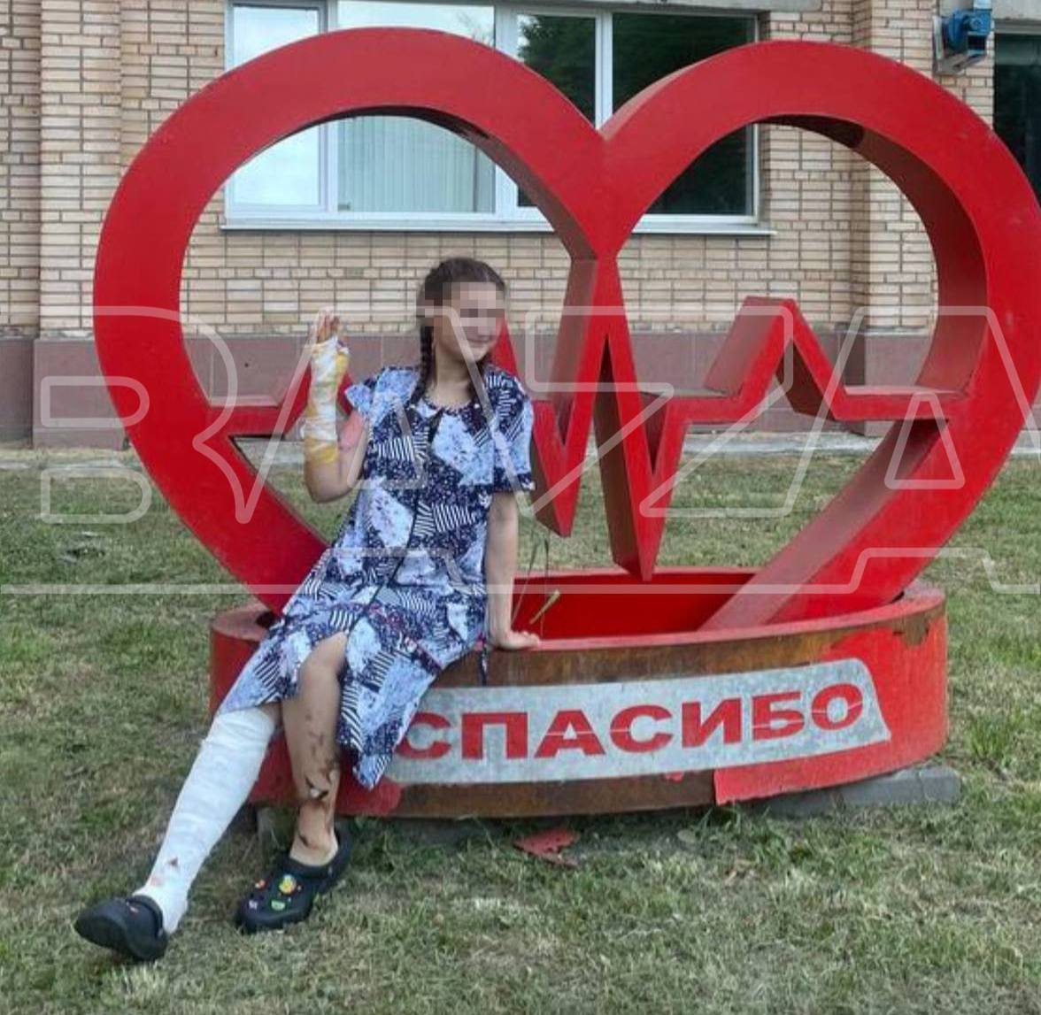 Жительница Рязани получила ожоги, перепутав самогон с водой