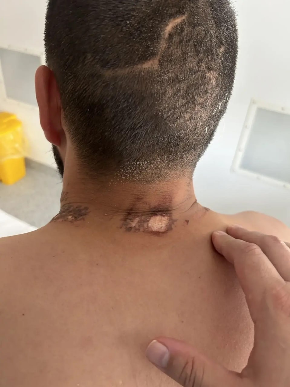 В Алтайском крае ветерана боевых действий ударила молния во время схватки с медведем