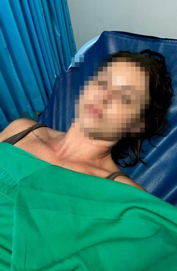 Россиянку парализовало после укуса медузы на Бали