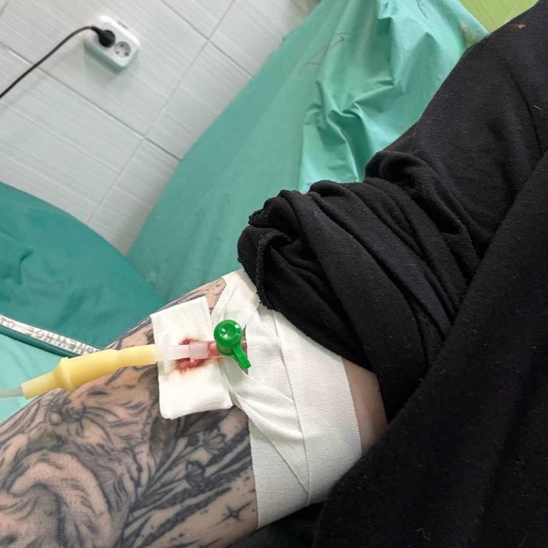 Россиянка попала в больницу из-за энергетиков