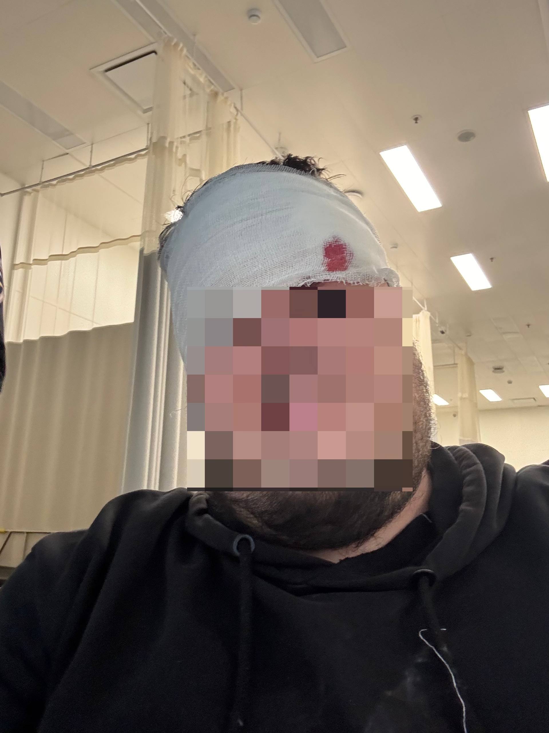 В московском метро на пассажира упал фрагмент лепнины