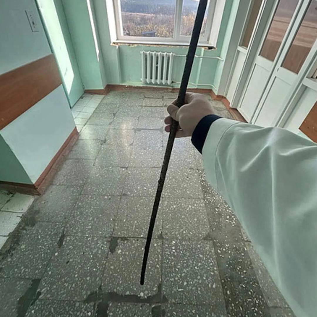 В Кировской области арматура проткнула 12-летнего мальчика